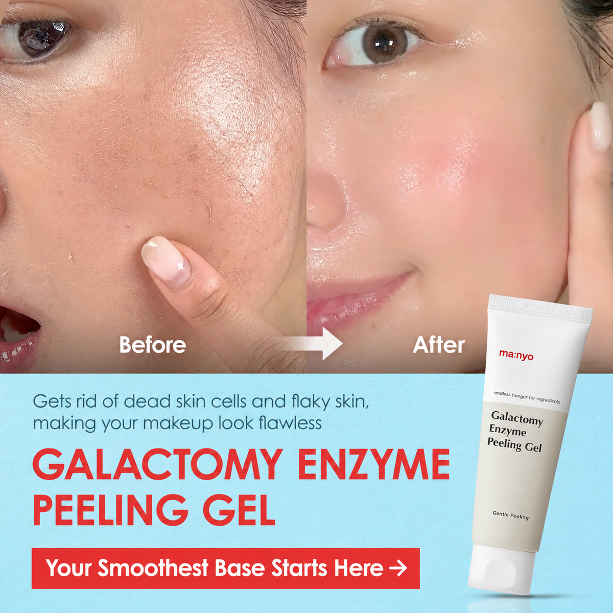 Galactomy Enzyme Peeling Gel