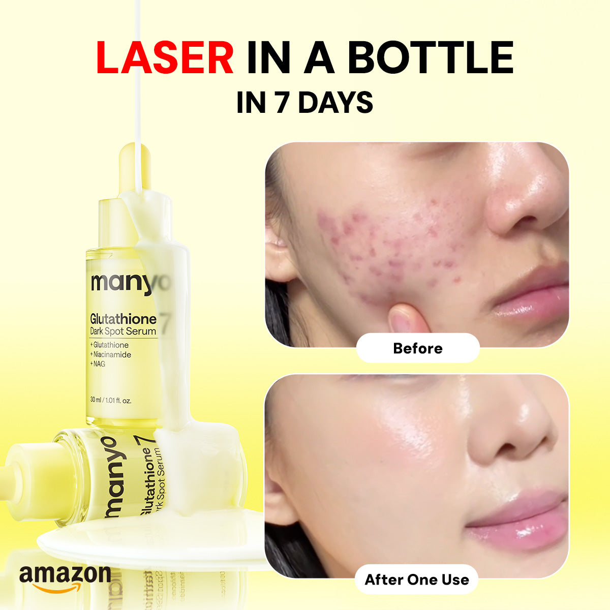 [KOREA & JAPAN NO.1] Glutathione 7 Dark Spot Serum